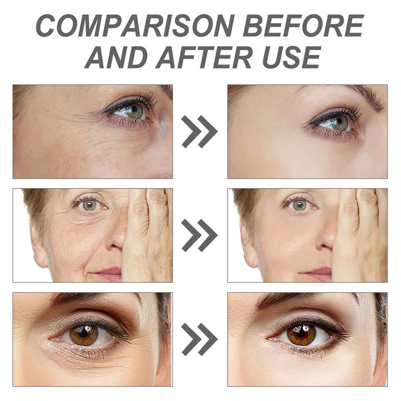 Retinol Remove Wrinkle Face Se - Milk Thistle Silymarin ulasan dan harga