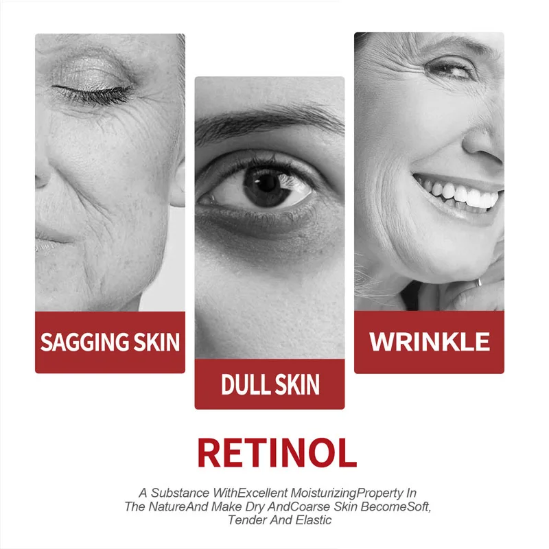 Retinol Cream  Moisturizing Sk - Milk Thistle Silymarin ulasan dan harga